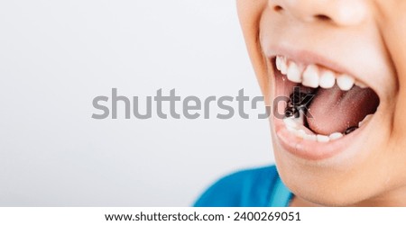 An image of a stainless steel crown used in dental health for kids with severe tooth decay or fractures. Dental restoration concept. Steel crown silver caps for kid problem teeth. Royalty-Free Stock Photo #2400269051