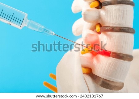 Medical blockade in the intervertebral disc herniation of the lumbar spine on a blue background. Concept for the treatment of protrusions and hernias of the spine. Copy space for text Royalty-Free Stock Photo #2402131767