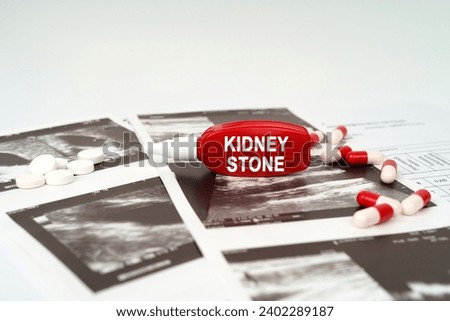 Medical concept. On the ultrasound pictures there are pills and a pen with the inscription - Kidney stone