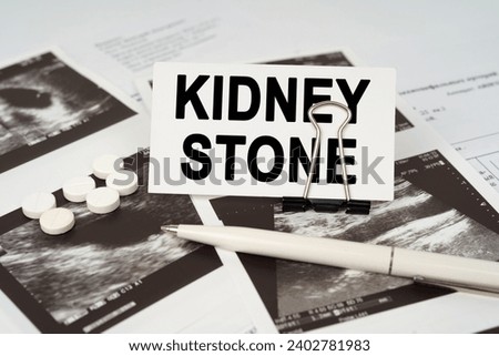 Medical concept. On the ultrasound pictures there is a pen and a business card with the inscription - Kidney stone