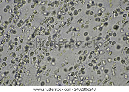 Coughing up mucus and phlegm from a chest infection from a virus and bacteria infection, looking at it under the microscope, with cells and microorganisms. Bacteria and skin cells Royalty-Free Stock Photo #2402806243