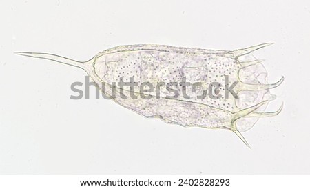 Freshwater rotifer, Keratella sp. Living sample. Stacked image Royalty-Free Stock Photo #2402828293