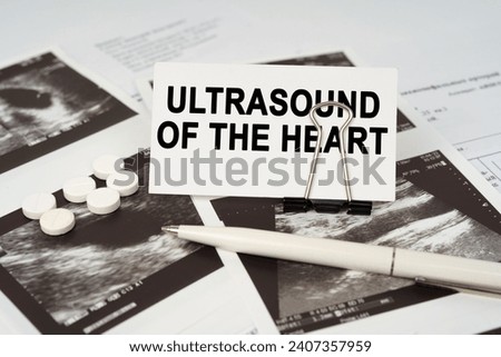 Medical concept. On the ultrasound pictures there is a pen and a business card with the inscription - Ultrasound of the heart