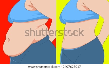 A woman's body with belly fat. Before, after. Healthcare illustration. Vector illustration.  Royalty-Free Stock Photo #2407628017