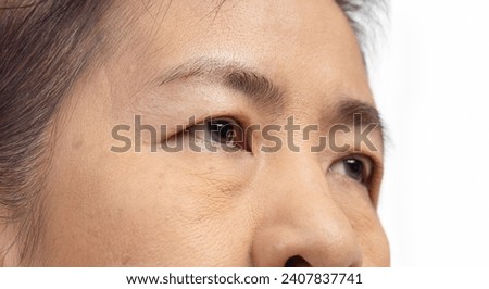 The ptosis or droopy eyelids in asian senior woman. Royalty-Free Stock Photo #2407837741
