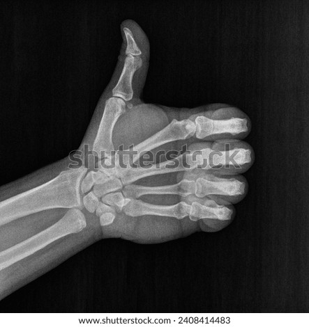 Film xray x-ray or radiograph of a thumb up associated with agreement, approval, confirmation or positivity in gestural language, manual communication, or signing aka sign language