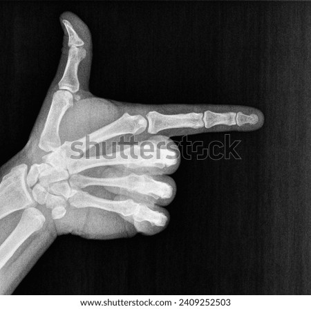 Film xray x-ray or radiograph of a thumb and finger in gestural language, manual communication, or signing aka sign language, pointing this way or that way to the right
