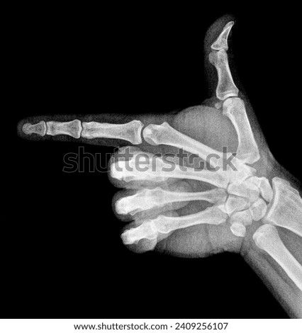 Film xray x-ray or radiograph of a thumb and finger in gestural language, manual communication, or signing aka sign language, pointing this way or that way to the left