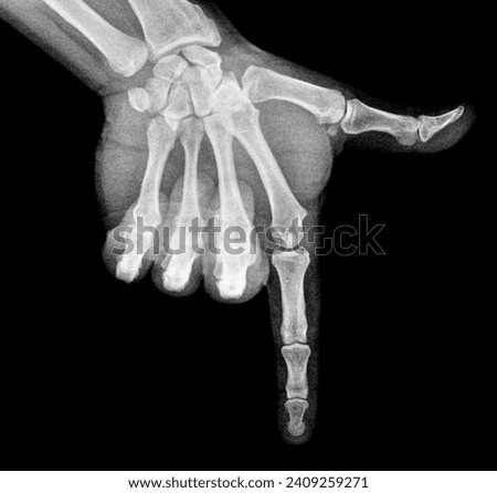Film xray x-ray or radiograph of a thumb and finger in gestural language, manual communication, or signing aka sign language, pointing this way or that way down or downward downstairs 
