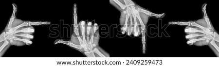 Film xray x-ray or radiograph of a thumb and finger in gestural language, manual communication, or signing aka sign language, pointing this way or that way in four directions, up, down, left, right