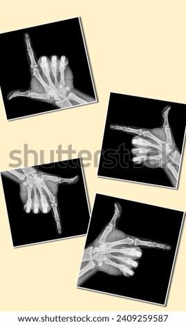 Film xray x-ray or radiograph of a thumb and finger in gestural language, manual communication, or signing aka sign language, pointing this way or that way in four directions, up, down, left, right