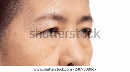 The ptosis or droopy eyelids in asian senior woman. Royalty-Free Stock Photo #2409808067