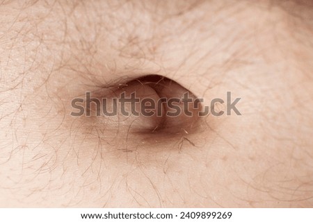 Lump in Belly Button - hernia, an inflammatory condition - possible cancer Royalty-Free Stock Photo #2409899269