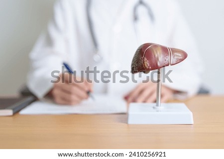 Doctor with human Liver anatomy model. Liver cancer and Tumor, Jaundice, Viral Hepatitis A, B, C, D, E, Cirrhosis, Failure, Enlarged, Hepatic Encephalopathy, Ascites Fluid in Belly and health concept Royalty-Free Stock Photo #2410256921