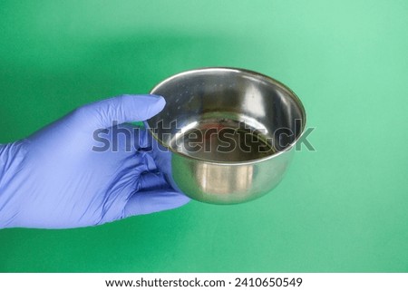 medical personnel wearing blue gloves holding sterile comms or instrument comms, usually use sterile fluids Royalty-Free Stock Photo #2410650549