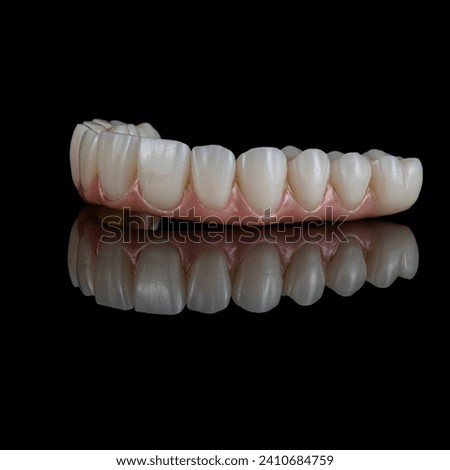 zircon bridge on 4 dental implants Royalty-Free Stock Photo #2410684759