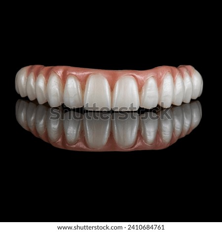 zircon bridge on 4 dental implants Royalty-Free Stock Photo #2410684761