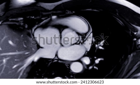 Cardiac MRI images are instrumental in assessing cardiac health, identifying heart abnormalities, and guiding treatment plans. Royalty-Free Stock Photo #2412306623
