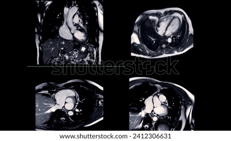 Cardiac MRI images are instrumental in assessing cardiac health, identifying heart abnormalities, and guiding treatment plans. Royalty-Free Stock Photo #2412306631