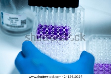 researcher in laboratory working with cell culture, cell culture at the medicine, medical and cell culture laboratory