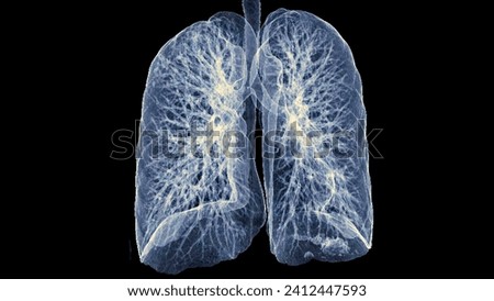 CT Chest or Lung 3d rendering image  showing Trachea and lung in respiratory system.	
