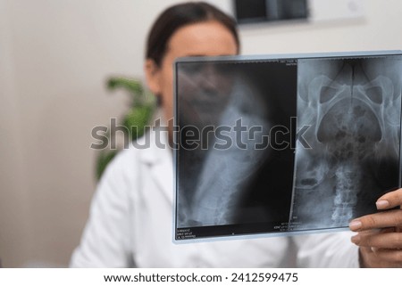 Diagnostic Radiography: A doctor in a hospital conducts a diagnostic evaluation of the patient's illness using a radiological X-ray film as part of medical healthcare.