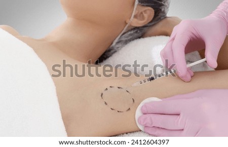 The doctor makes intramuscular injections of botulinum toxin in the underarm area against hyperhidrosis. Royalty-Free Stock Photo #2412604397