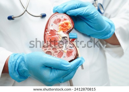 Chronic kidney disease, doctor with model for treatment urinary system, urology, Estimated glomerular filtration rate eGFR. Royalty-Free Stock Photo #2412870815