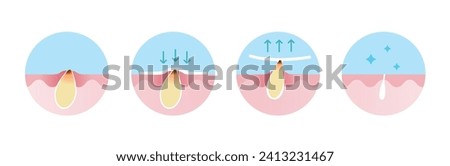 Step of blackhead removal vector icon set illustration isolated on white background. Cross section of blackhead treatment process, apply, peel off, unclogging and tighten pore. Skin care concept. Royalty-Free Stock Photo #2413231467