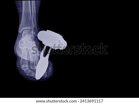 X-rays of the foot to see broken bones and large objects penetrating the foot on a black background.