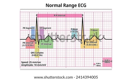 Normal Range ECG - PR Interval, QRS Complex, QT Interval, P and T Wave - Electrocardiogram Medical Vector Illustration Royalty-Free Stock Photo #2414394005