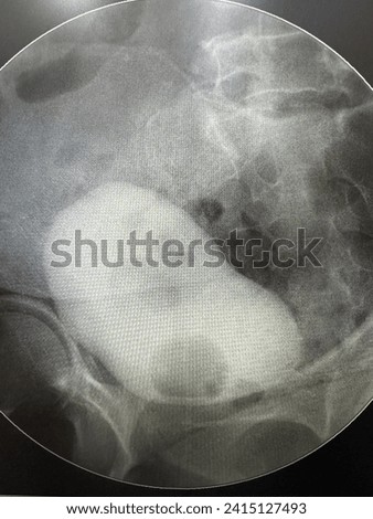 oblique views of full bladder under fluoroscopy Royalty-Free Stock Photo #2415127493