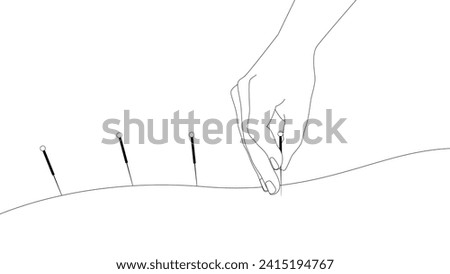 Hand of doctor performing acupuncture therapy. Alternative medicine concept, vector illustration, clip art in black and white outline.