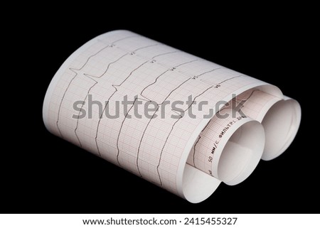 Cardiogram printed on paper, rolled into a roll, on a black background
