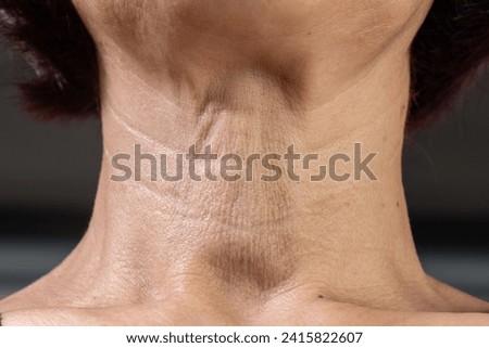Neck  wrinkles and lines of senior woman. Facial and Neck Skin Aging Change on senior woman. Royalty-Free Stock Photo #2415822607
