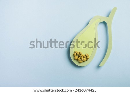 Gallbladder decorative model with gallstones on pastel blue background. Gallbladder disease concept. Top view, copy space Royalty-Free Stock Photo #2416074425