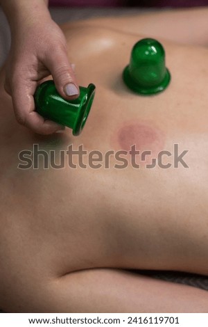 A woman undergoing a massage using vacuum plastic jars. Vertical photo.