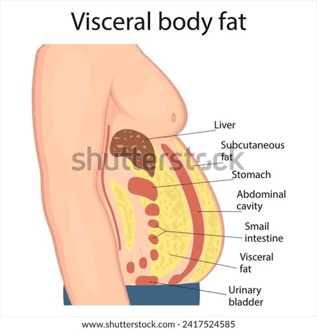 Visceral fat and subcutaneous fat accumulate around organs. Medicine and health diagram about belly fat. Royalty-Free Stock Photo #2417524585