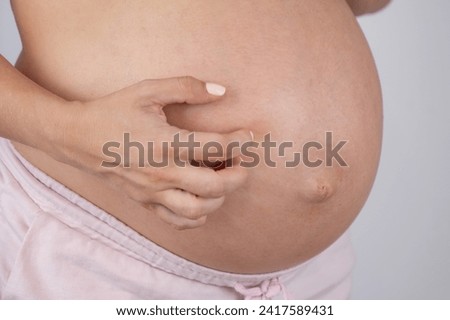 A woman scratches her stomach. Skin allergies during pregnancy. Royalty-Free Stock Photo #2417589431
