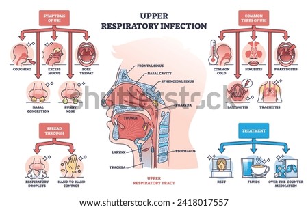 Upper respiratory infection with symptoms and types outline diagram. Labeled educational health condition scheme with coughing, sore throat and nasal problems vector illustration. Medical description Royalty-Free Stock Photo #2418017557