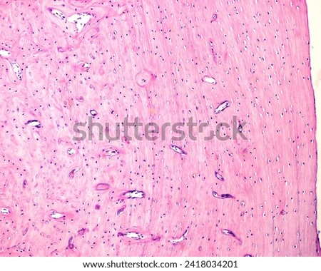 Bone. Near the surface of the compact bone, the bony lamellae are arranged parallel to the surface; these are called circumferential lamellae. Royalty-Free Stock Photo #2418034201