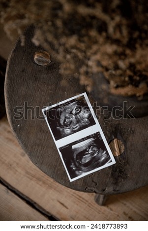 Ultrasound scan baby on wooden table