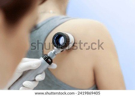 dermatologist examines birthmarks on the patient's skin with a dermatoscope. Dermatology, skin mole examining. looking for signs of melonoma or skin cancer. Royalty-Free Stock Photo #2419869405