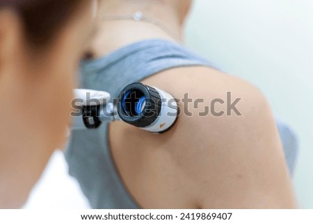 dermatologist examines birthmarks on the patient's skin with a dermatoscope. Dermatology, skin mole examining. looking for signs of melonoma or skin cancer. Royalty-Free Stock Photo #2419869407