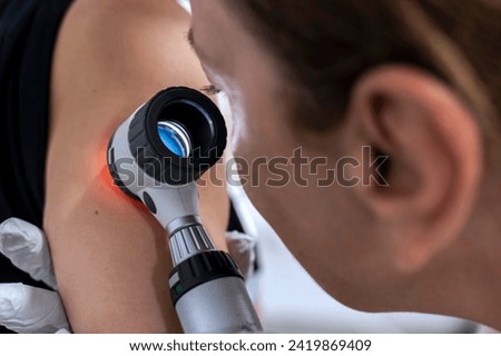 dermatologist examines birthmarks on the patient's skin with a dermatoscope. Dermatology, skin mole examining. looking for signs of melonoma or skin cancer. Royalty-Free Stock Photo #2419869409