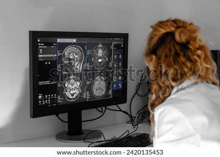 A doctor radiologist in a hospital mri ct magnetic resonance imageing analysis room reading X-rays of a brain, head and other parts of the body. The doctor makes notes by speaking into a dictaphone	