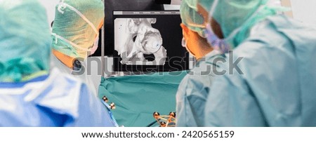 Team of doctor perform total hip arthroplasty replacement surgery in osteoarthritis patient inside the operating room. robot-assisted - robotic hip and knee replacement surgery	 Royalty-Free Stock Photo #2420565159