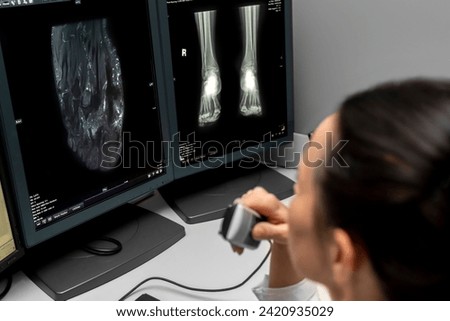radiology doctor examines foot, ankle x-ray, mr image and reports with microphone looking computer screen, X-ray analysis room reading X-rays of a heel, toe and other parts of the body.	