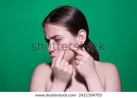 Sad Woman squeeze out pimples on cheek. Acne and pimple on skin. Dermatology, puberty woman. Pimples problem skin. Girl Squeeze out Pimple on skin cheek. Care from skin problem. Pimple face. Royalty-Free Stock Photo #2421104703