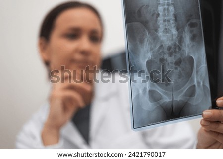 Pensive doctor analyzes X-ray picture of patient pelvis young female practitioner makes diagnosis working in modern hospital closeup on blurred background